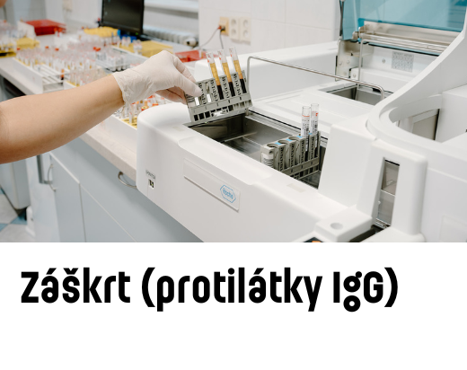 Záškrt (protilátky IgG)