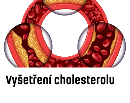 Vyšetření cholesterolu
