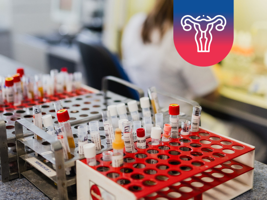 Vyšetření AMH (Anti-Mülleriánský hormon)