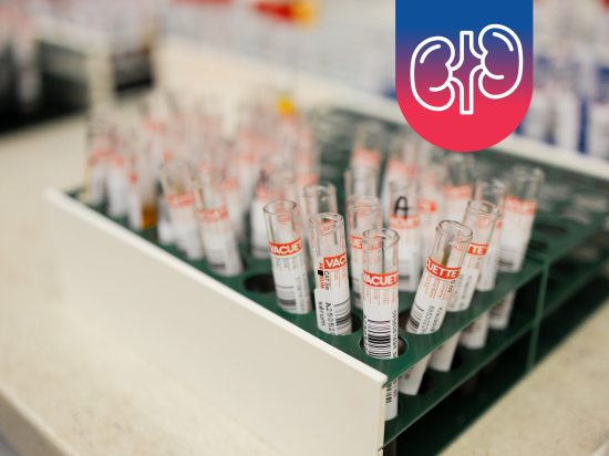 Vyšetření ledvin z krve