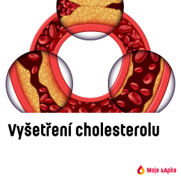 Vyšetření cholesterolu