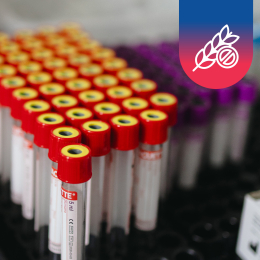 Celiakie (screening) IgA + Tkáňová transglutamináza IgA + krátká interpretace