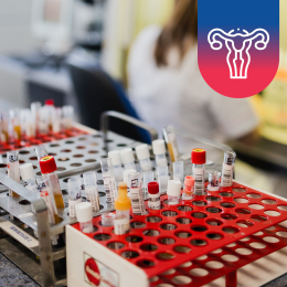 Vyšetření AMH (Anti-Mülleriánský hormon)