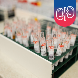 Vyšetření ledvin z krve